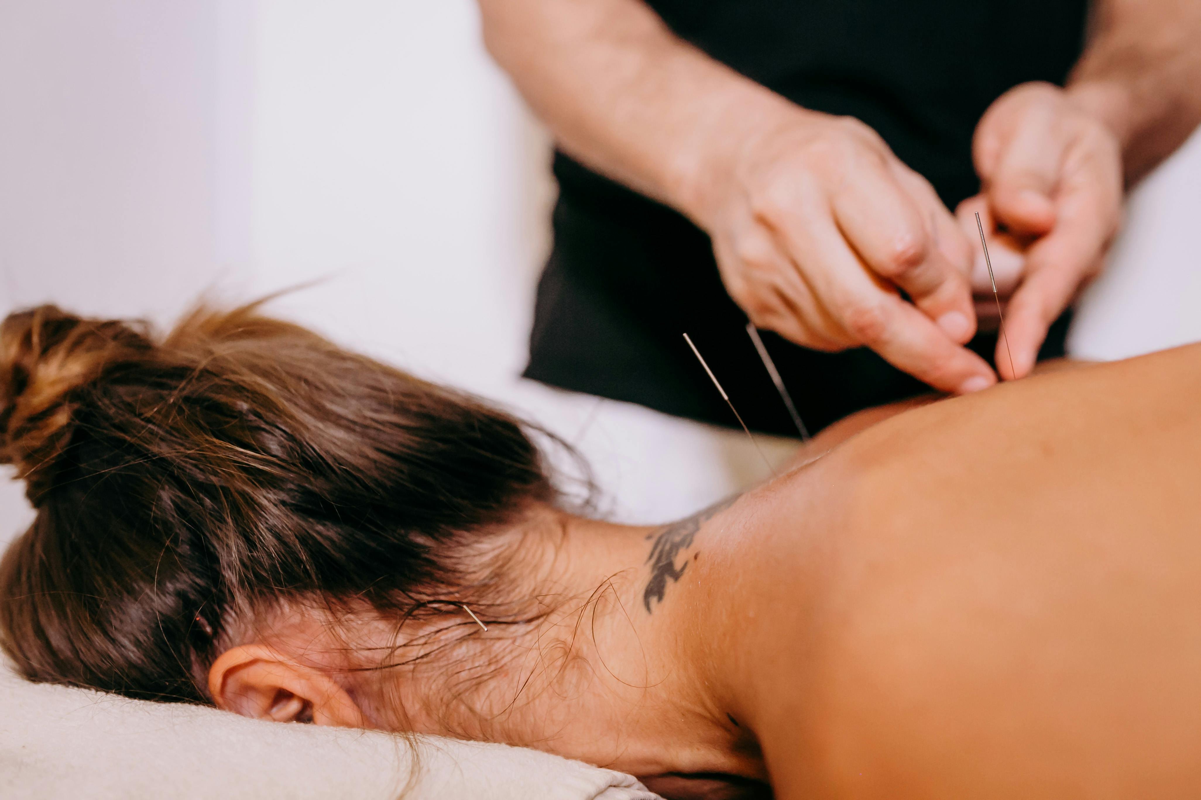 Les secrets de l’acupuncture pour rétablir votre équilibre énergétique